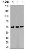 AKT2 Antibody - Western blot analysis of AKT2 expression in HeLa (A); NIH3T3 (B); PC12 (C) whole cell lysates.