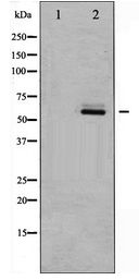 AKT2 Antibody - Western blot of Akt2 expression in TNF- alpha treated A2780 whole cell lysates,The lane on the left is treated with the antigen-specific peptide.