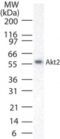 AKT2 Antibody - Western blot of AKT2/3 using Polyclonal Antibody to Akt2 at 1 ug/ml against 15 ug of HeLa lysate.