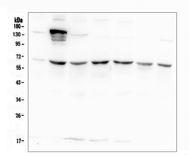 AKT2 Antibody - Western blot analysis of AKT2 using anti-AKT2 antibody. Electrophoresis was performed on a 5-20% SDS-PAGE gel at 70V (Stacking gel) / 90V (Resolving gel) for 2-3 hours. The sample well of each lane was loaded with 50ug of sample under reducing conditions. Lane 1: human A549 whole cell lysate, Lane 2: human 293T whole cell lysate, Lane 3: human HELA whole cell lysate, Lane 4: human Caco-2 whole cell lysate, Lane 5: human K562 whole cell lysate, Lane 6: human HL-60 whole cell lysate, Lane 7: human PC-3 whole cell lysate. After Electrophoresis, proteins were transferred to a Nitrocellulose membrane at 150mA for 50-90 minutes. Blocked the membrane with 5% Non-fat Milk/ TBS for 1.5 hour at RT. The membrane was incubated with mouse anti-AKT2 antigen affinity purified monoclonal antibody at 0.5 µg/mL overnight at 4°C, then washed with TBS-0.1% Tween 3 times with 5 minutes each and probed with a goat anti-mouse IgG-HRP secondary antibody at a dilution of 1:10000 for 1.5 hour at RT. The signal is developed using an Enhanced Chemiluminescent detection (ECL) kit with Tanon 5200 system.