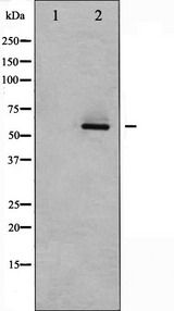 AKT2 Antibody - Western blot analysis of Akt2 expression in TNF-a treated A2780 whole cells lysates. The lane on the left is treated with the antigen-specific peptide.