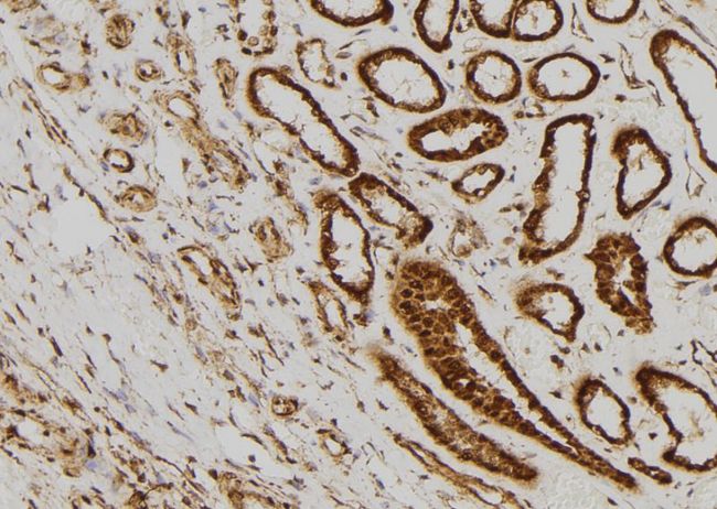 AKT2 Antibody - 1:100 staining human kidney tissue by IHC-P. The sample was formaldehyde fixed and a heat mediated antigen retrieval step in citrate buffer was performed. The sample was then blocked and incubated with the antibody for 1.5 hours at 22°C. An HRP conjugated goat anti-rabbit antibody was used as the secondary.
