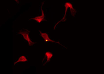 AKT2 Antibody - Staining A2780 cells by IF/ICC. The samples were fixed with PFA and permeabilized in 0.1% Triton X-100, then blocked in 10% serum for 45 min at 25°C. The primary antibody was diluted at 1:200 and incubated with the sample for 1 hour at 37°C. An Alexa Fluor 594 conjugated goat anti-rabbit IgG (H+L) Ab, diluted at 1/600, was used as the secondary antibody.