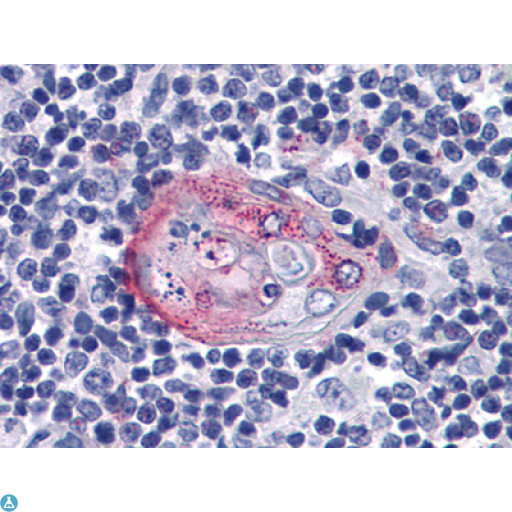 AKT2 Antibody - Immunohistochemistry (IHC) analysis of paraffin-embedded human Thymus tissues with AEC staining using Akt2 Monoclonal Antibody.