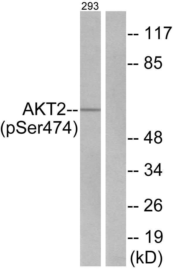 AKT2 Antibody - Western blot analysis of lysates from 293 cells treated with EGF 200ng/ml 30', using Akt2 (Phospho-Ser474) Antibody. The lane on the right is blocked with the phospho peptide.