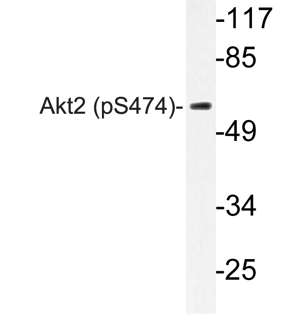 AKT2 Antibody - Western blot of p-Akt2 (S474) pAb in extracts from 293 EGF cells.