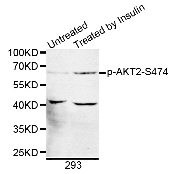 AKT2 Antibody - Western blot analysis of extracts of 293 cells.