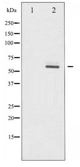 AKT2 Antibody - Western blot of Akt2 phosphorylation expression in TNF- alpha treated A2780 whole cell lysates,The lane on the left is treated with the antigen-specific peptide.