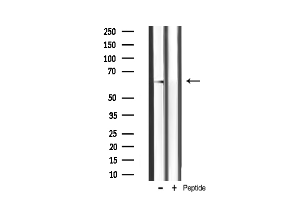 AKT2 Antibody - Western blot analysis of akt2 phosphorylation expression in mouse brain tissue lysates. The lane on the right is treated with the antigen-specific peptide.