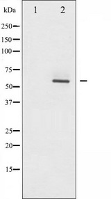 AKT2 Antibody - Western blot analysis of Akt2 phosphorylation expression in TNF-a treated A2780 whole cells lysates. The lane on the left is treated with the antigen-specific peptide.