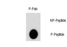 AKT2 Antibody - Dot blot of Phospho-AKT2-S474 polyclonal antibody on nitrocellulose membrane. 50ng of Phospho-peptide or Non Phospho-peptide per dot were adsorbed. Antibody working concentration was 0.5ug per ml. P-antibody: phospho-antibody; P-Peptide: phospho-peptide; NP-Peptide: non-phospho-peptide.