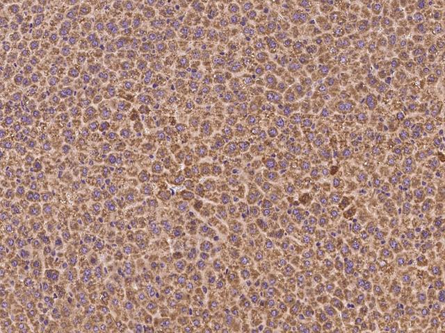 AKT2 Antibody - Immunochemical staining of mouse AKT2 in mouse liver with rabbit polyclonal antibody at 1:300 dilution, formalin-fixed paraffin embedded sections.