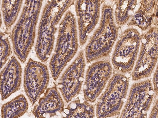 AKT2 Antibody - Immunochemical staining of mouse AKT2 in mouse small intestine with rabbit polyclonal antibody at 1:300 dilution, formalin-fixed paraffin embedded sections.