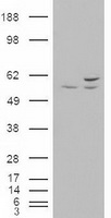 AKT3 Antibody - HEK293T cells were transfected with the pCMV6-ENTRY control (Left lane) or pCMV6-ENTRY AKT3 (Right lane) cDNA for 48 hrs and lysed. Equivalent amounts of cell lysates (5 ug per lane) were separated by SDS-PAGE and immunoblotted with anti-AKT3.
