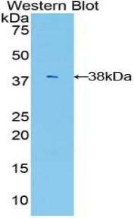 AKT3 Antibody - Western blot of recombinant AKT3.  This image was taken for the unconjugated form of this product. Other forms have not been tested.