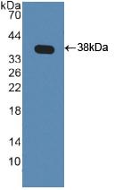 AKT3 Antibody - Western Blot; Sample: Recombinant PKBg, Human.