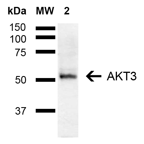 AKT3 Antibody - Western blot analysis of Mouse Brain showing detection of ~55 kDa AKT3 protein using Rabbit Anti-AKT3 Polyclonal Antibody. Lane 1: Molecular Weight Ladder (MW). Lane 2: Mouse Brain. Load: 15 µg. Block: 5% Skim Milk in 1X TBST. Primary Antibody: Rabbit Anti-AKT3 Polyclonal Antibody  at 1:1000 for 2 hours at RT. Secondary Antibody: Goat Anti-Rabbit IgG: HRP at 1:3000 for 1 hour at RT. Color Development: ECL solution for 5 min at RT. Predicted/Observed Size: ~55 kDa.