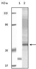 AKT3 Antibody - AKT3 Antibody in Western Blot (WB)