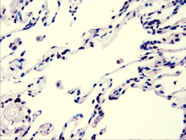 AKT3 Antibody - Immunohistochemical staining of paraffin-embedded Human lung tissue using anti-AKT3 mouse monoclonal antibody.