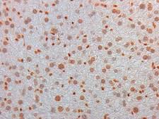 AKT3 Antibody - Immunohistochemistry of Mouse Monoclonal anti AKT3 unconjugated Antibody in Mouse Embryonic Kidney. Tissue: Mouse Liver. Fixation: FFPE buffered formalin 10% conc. Ag Retrieval: Heat, Citrate pH 6.2. Pressure Cooker. Primary antibody: 2ug/ml 1.5 hour @ room T. Secondary Ab: MOUSE ON MOUSE HRP POLYMER 45” RT.