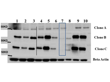 AKT3 Antibody - Western Blot of Mouse Anti-AKT3 antibody. Lane 1: C2C12. Lane 2: MEF#1. Lane 3: MEF#2. Lane 4: A549. Lane 5: Calu-1. Lane 6: PC3. Lane 7: HepG2. Lane 8: Jurkat. Lane 9: SKOV3. Lane 10: 293T. Load: 35 µg per lane. Primary antibody: AKT-3 unconjugated antibody at 1:1000 for overnight at 4°C. Secondary antibody: Anti mouse secondary antibody at 1:20,000 for 1 h at RT. Block: 5% BLOTTO overnight at 4°C. Predicted/Observed size: 56 kDa for AKT3.