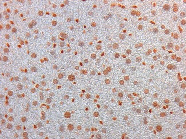 AKT3 Antibody - Immunohistochemistry of Mouse Monoclonal anti AKT3 unconjugated Antibody in Mouse Embryonic Kidney. Tissue: Mouse Liver. Fixation: FFPE buffered formalin 10% conc. Ag Retrieval: Heat, Citrate pH 6.2. Pressure Cooker. Primary antibody: 2ug/ml 1.5 hour @ room T. Secondary Ab: MOUSE ON MOUSE HRP POLYMER 45” RT.