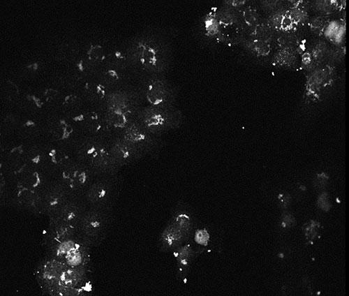 AKT3 Antibody - Immunofluorescence of Mouse monoclonal anti-AKT3 antibody Cell Type: A431 cells Fixation: 4% paraformaldehyde 10 min Permeablization: 0.5% Triton X 30 min Primary Ab: 1:250 72 hours 4°C Secondary Ab: 1:1000 Overnight 4°C