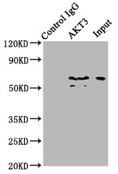 AKT3 Antibody - Immunoprecipitating AKT3 in mouse brain whole cell lysate Lane 1: Rabbit control IgG (1µg) instead of AKT3 Antibody in mouse brain whole cell lysate.For western blotting, a HRP-conjugated Protein G antibody was used as the secondary antibody (1/2000) Lane 2: AKT3 Antibody (6µg) + Mouse brain whole cell lysate (500µg) Lane 3: Mouse brain whole cell lysate (10µg)