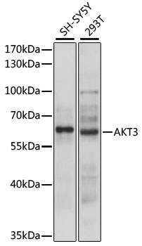 AKT3 Antibody - Western blot analysis of extracts of various cell lines, using AKT3 antibody at 1:3000 dilution. The secondary antibody used was an HRP Goat Anti-Rabbit IgG (H+L) at 1:10000 dilution. Lysates were loaded 25ug per lane and 3% nonfat dry milk in TBST was used for blocking. An ECL Kit was used for detection and the exposure time was 90s.
