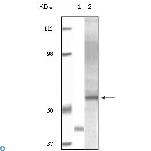 AKT3 Antibody - Western Blot (WB) analysis using Akt3 Monoclonal Antibody against truncated Akt3 recombinant protein (1) and Human Ovary carcinoma tissue lysate (2).