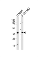 AKTIP / FTS Antibody - Western blot of lysates from human heart tissue lysate, U-251 MG cell line (from left to right), using AKTIP Antibody. Antibody was diluted at 1:1000 at each lane. A goat anti-rabbit IgG H&L (HRP) at 1:5000 dilution was used as the secondary antibody. Lysates at 35ug per lane.