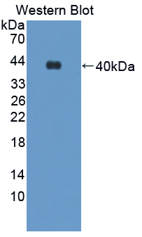 ALAD Antibody - Western blot of ALAD antibody.