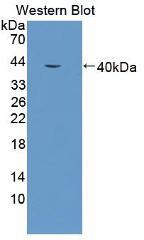 ALAD Antibody - Western blot of ALAD antibody.
