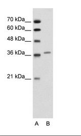 ALAD Antibody - A: Marker, B: Jurkat Cell Lysate.  This image was taken for the unconjugated form of this product. Other forms have not been tested.