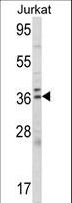 ALAD Antibody - Western blot of ALAD Antibody in Jurkat cell line lysates (35 ug/lane). ALAD (arrow) was detected using the purified antibody.