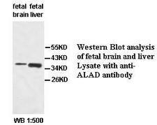 ALAD Antibody