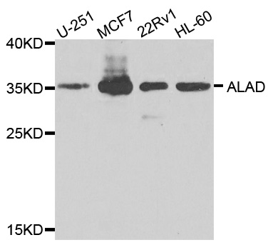 ALAD Antibody - Western blot analysis of extracts of various cells.