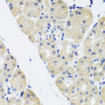 ALAD Antibody - Immunohistochemistry of paraffin-embedded human stomach tissue.
