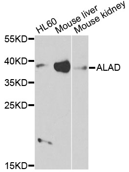 ALAD Antibody - Western blot analysis of extracts of various cell lines, using ALAD antibody at 1:1000 dilution. The secondary antibody used was an HRP Goat Anti-Rabbit IgG (H+L) at 1:10000 dilution. Lysates were loaded 25ug per lane and 3% nonfat dry milk in TBST was used for blocking. An ECL Kit was used for detection and the exposure time was 90s.