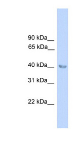 ALAD Antibody - ALAD antibody Western blot of Fetal Muscle lysate. This image was taken for the unconjugated form of this product. Other forms have not been tested.