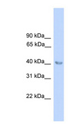 ALAD Antibody - ALAD antibody Western blot of Fetal Muscle lysate. This image was taken for the unconjugated form of this product. Other forms have not been tested.