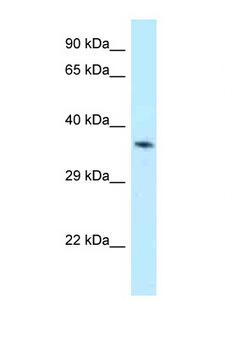 ALAD Antibody - ALAD antibody Western blot of Mouse Thymus lysate. Antibody concentration 1 ug/ml.  This image was taken for the unconjugated form of this product. Other forms have not been tested.