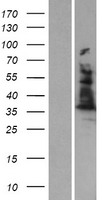 ALAD Protein - Western validation with an anti-DDK antibody * L: Control HEK293 lysate R: Over-expression lysate