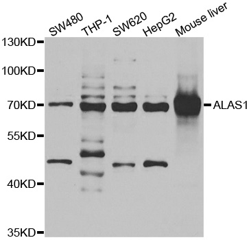 ALAS1 Antibody - Western blot analysis of extracts of various cell lines.
