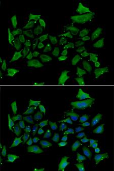 ALAS1 Antibody - Immunofluorescence analysis of HeLa cells.