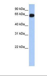 ALAS1 Antibody - Human Fetal lung lysate. Antibody concentration: 1.0 ug/ml. Gel concentration: 12%.  This image was taken for the unconjugated form of this product. Other forms have not been tested.