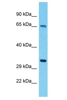 ALAS1 Antibody - ALAS1 antibody Western Blot of 293T. Antibody dilution: 1 ug/ml.  This image was taken for the unconjugated form of this product. Other forms have not been tested.