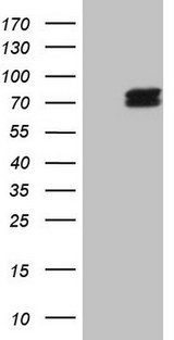 ALAS1 Antibody - HEK293T cells were transfected with the pCMV6-ENTRY control (Left lane) or pCMV6-ENTRY ALAS1 (Right lane) cDNA for 48 hrs and lysed. Equivalent amounts of cell lysates (5 ug per lane) were separated by SDS-PAGE and immunoblotted with anti-ALAS1 (1:2000).