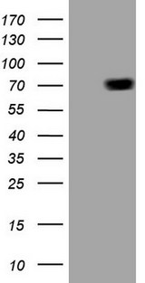 ALAS1 Antibody - HEK293T cells were transfected with the pCMV6-ENTRY control. (Left lane) or pCMV6-ENTRY ALAS1. (Right lane) cDNA for 48 hrs and lysed. Equivalent amounts of cell lysates. (5 ug per lane) were separated by SDS-PAGE and immunoblotted with anti-ALAS1. (1:2000)