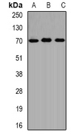 ALAS1 Antibody - Western blot analysis of ALAS-H expression in SW620 (A); HepG2 (B); mouse liver (C) whole cell lysates.